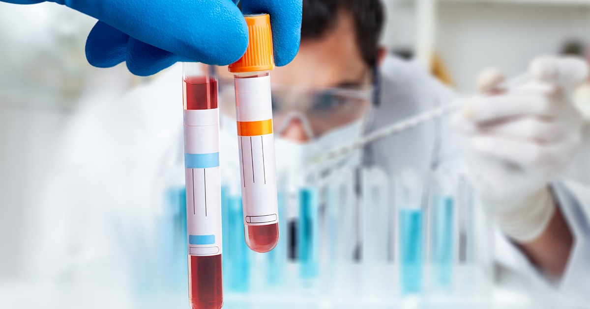 Doctor holding blood sample in test tube